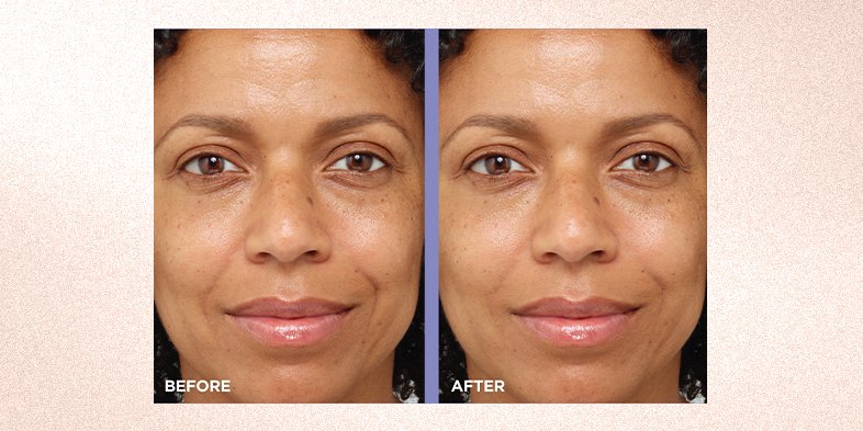 InArticlespafacial101RevitaLift Micro Hyaluronic Acid Ceramides LinePlumping Water Cream